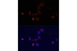 Immunofluorescence analysis of PC-12 cells using WDR81 antibody (ABIN6294099) at dilution of 1:100. (WDR81 抗体)