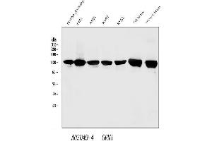 Western blot analysis of mGluR1/GRM1 using anti-mGluR1/GRM1 antibody (ABIN7600912).