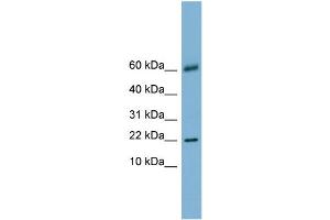 WB Suggested Anti-LGALS14 Antibody Titration:  0. (LGALS14 抗体  (N-Term))