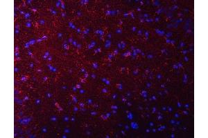 IF analysis of Septin 2/SEPTIN2 using anti-Septin 2/SEPTIN2 antibody (ABIN7599275). (Septin 2 抗体  (AA 1-326))