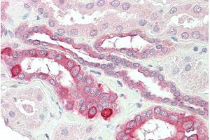 ABIN185517 (5µg/ml) staining of paraffin embedded Human Kidney. (HVEM 抗体  (Internal Region))