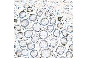 Immunohistochemistry analysis of paraffin-embedded human colon using EIF2S2 (ABIN7073880) at dilution of 1: 1000