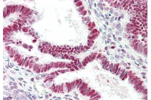 Rabbit Anti-RNASEH1 antibody  Formalin Fixed Paraffin Embedded Tissue: Human Uterus Primary antibody Concentration: 1:100 Secondary Antibody: Donkey anti-Rabbit-Cy3 Secondary Antibody Concentration: 1:200 Magnification: 20x Exposure Time: 0. (Ribonuclease H1 抗体  (Middle Region))