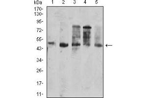 Western Blotting (WB) image for anti-CD177 Molecule (CD177) (AA 22-161) antibody (ABIN7193297)