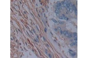 IHC-P analysis of Human Tissue, with DAB staining. (MAP2K7 抗体  (AA 113-388))