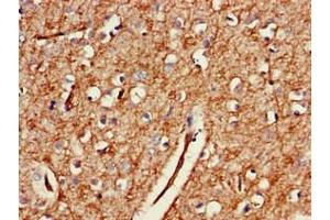 Immunohistochemistry of paraffin-embedded human brain tissue using ABIN7154436 at dilution of 1:100