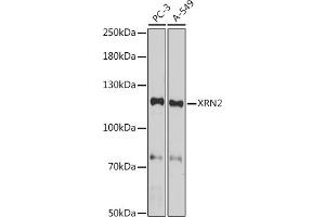 Western blot analysis of extracts of various cell lines, using XRN2 antibody (ABIN7265345) at 1:1000 dilution. (XRN2 抗体)