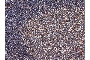 Image no. 9 for anti-Tripartite Motif Containing 38 (TRIM38) (AA 1-265) antibody (ABIN1490681)