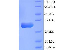 SDS-PAGE (SDS) image for Carbonyl Reductase 1 (CBR1) (AA 45-320), (partial) protein (His tag) (ABIN5713318) (CBR1 Protein (AA 45-320, partial) (His tag))