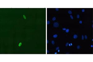 Immunofluorescent staining using P2B1 mouse monoclonal anti-DUX4 N-terminus on C2C12 myoblasts transfected with pCS2+DUX4. (DUX4 抗体)