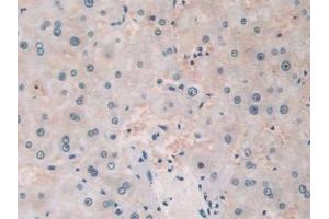 Detection of TLR3 in Human Liver Tissue using Polyclonal Antibody to Toll Like Receptor 3 (TLR3) (TLR3 抗体  (AA 404-532))