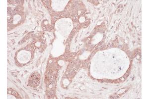 Immunohistochemistry (IHC) image for anti-Sequestosome 1 (SQSTM1) (AA 325-375) antibody (ABIN7454876) (SQSTM1 抗体  (AA 325-375))