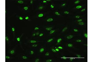 Immunofluorescence of monoclonal antibody to MAGEA2 on HeLa cell. (MAGEA2 抗体  (AA 1-314))