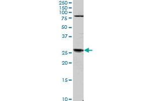 TGIF2 monoclonal antibody (M01), clone 4C10. (TGIF2 抗体  (AA 131-236))