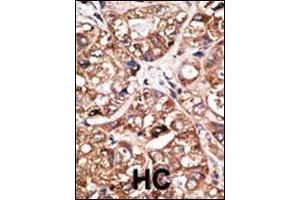 Image no. 1 for anti-Neuronal Differentiation 1 (NEUROD1) (AA 15-45) antibody (ABIN2451575) (NEUROD1 抗体  (AA 15-45))