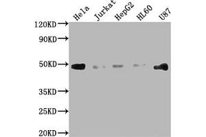 Western Blot Positive WB detected in: Hela whole cell lysate, Jurkat whole cell lysate, HepG2 whole cell lysate, HL60 whole cell lysate, U87 whole cell lysate All lanes: FAS antibody at 1:2000 Secondary Goat polyclonal to rabbit IgG at 1/50000 dilution Predicted band size: 38, 12, 10, 17, 15, 36, 25 kDa Observed band size: 45 kDa