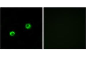 Immunofluorescence analysis of MCF7 cells, using ARSI Antibody. (Arylsulfatase I 抗体  (AA 311-360))