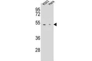 Western Blotting (WB) image for anti-Carboxypeptidase B1 (Tissue) (CPB1) antibody (ABIN2996494) (CPB1 抗体)