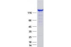 Validation with Western Blot