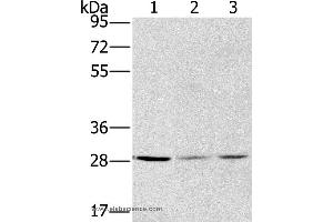 Western blot analysis of A375, hela and A172 cell, using HSD17B12 Polyclonal Antibody at dilution of 1:570 (HSD17B12 抗体)