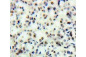 Used in DAB staining on fromalin fixed paraffin-embedded Kidney tissue (TOP2 抗体  (AA 749-987))