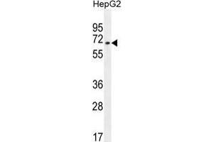 ZNF860 Antibody (C-term) western blot analysis in HepG2 cell line lysates (35 µg/lane). (ZNF860 抗体  (C-Term))