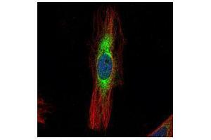 ICC/IF Image Confocal immunofluorescence analysis (Olympus FV10i) of methanol-fixed HeLa, using SCIN, antibody (Green) at 1:500 dilution. (Scinderin 抗体)