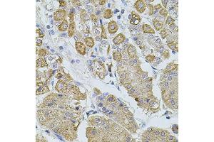Immunohistochemistry (IHC) image for anti-Transient Receptor Potential Cation Channel, Subfamily A, Member 1 (TRPA1) (AA 850-950) antibody (ABIN6149565)