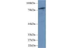 Western blot analysis of Mouse Skeletal muscle lysate, using Human PLCd4 Antibody (1 µg/ml) and HRP-conjugated Goat Anti-Rabbit antibody ( (PLCD4 抗体  (AA 1-250))