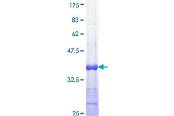 SMO Protein (AA 56-155) (GST tag)