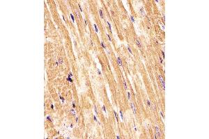 (ABIN6242629 and ABIN6577967) staining (Mouse) Smad1 in Mouse heart tissue sections by Immunohistochemistry (IHC-P - paraformaldehyde-fixed, paraffin-embedded sections).