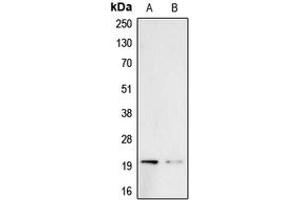 Western blot analysis of Probetacellulin expression in A431 (A), PC3 (B) whole cell lysates. (Betacellulin 抗体  (Center))