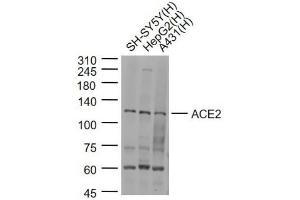 Lane 1: SH-SY5Y cell lysates; Lane 2: HepG2 cell lysates; Lane 3: A431 cell lysates probed with ACE2 Polyclonal Antibody, Unconjugated (bs-23443R) at 1:1000 dilution and 4˚C overnight incubation.