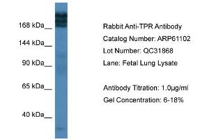 Western Blotting (WB) image for anti-Nucleoprotein TPR (TPR) (C-Term) antibody (ABIN2788674) (TPR 抗体  (C-Term))