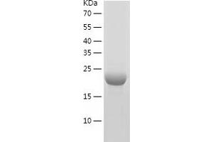 CENPM Protein (AA 1-180) (His tag)