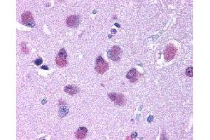 Immunohistochemical (Formalin/PFA-fixed paraffin-embedded sections) staining in human brain with BRS3 polyclonal antibody . (BRS3 抗体)