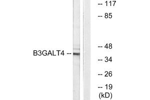 Western blot analysis of extracts from Jurkat cells, using B3GALT4 antibody. (B3GALT4 抗体  (Internal Region))