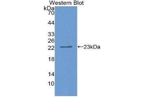 Western Blotting (WB) image for anti-SIVA1, Apoptosis-Inducing Factor (SIVA1) (AA 1-175) antibody (ABIN1867122) (SIVA1 抗体  (AA 1-175))