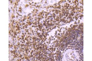 Paraformaldehyde-fixed, paraffin embedded Human spleen tissue, Antigen retrieval by boiling in sodium citrate buffer (pH6. (STAT5B 抗体)