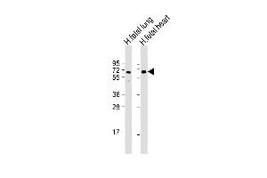 All lanes : Anti-ALG6 Antibody (Center) at 1:2000 dilution Lane 1: human fetal lung lysate Lane 2: human fetal heart lysate Lysates/proteins at 20 μg per lane. (ALG6 抗体  (AA 241-274))