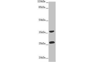 Western blot All lanes: RAB12 antibody at 2 μg/mL + Hela whole cell lysate Secondary Goat polyclonal to rabbit IgG at 1/10000 dilution Predicted band size: 28 kDa Observed band size: 28, 36 kDa (RAB12 抗体  (AA 98-241))