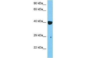 Host:  Mouse  Target Name:  RARB  Sample Tissue:  Mouse Skeletal Muscle  Antibody Dilution:  1ug/ml (Retinoic Acid Receptor beta 抗体  (C-Term))