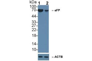 Knockout Varification: ;Lane 1: Wild-type HepG2 cell lysate; ;Lane 2: aFP knockout HepG2 cell lysate; ;Predicted MW: 69kDa ;Observed MW: 69kDa;Primary Ab: 2µg/ml Rabbit Anti-Human aFP Antibody;Second Ab: 0.