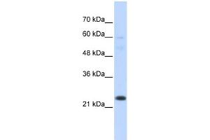 WB Suggested Anti-TAF12 Antibody Titration:  0. (TAF12 抗体  (N-Term))