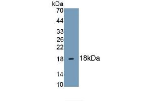 Detection of Recombinant HBEGF, Human using Monoclonal Antibody to Heparin Binding Epidermal Growth Factor Like Growth Factor (HBEGF) (HBEGF 抗体  (AA 21-160))