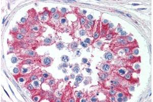 Human Testis (formalin-fixed, paraffin-embedded) stained with SMAD6 antibody ABIN295868 at 5 ug/ml followed by biotinylated goat anti-rabbit IgG secondary antibody ABIN481713, alkaline phosphatase-streptavidin and chromogen. (SMAD6 抗体  (AA 85-99))