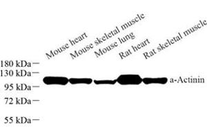 Western blot analysis of Sarcomeric α Actinin (ABIN7075510) at dilution of 1: 1000 (Sarcomeric alpha Actinin 抗体)