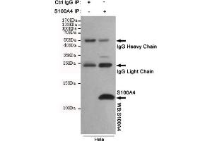 Immunoprecipitation analysis of Hela cell lysates using S100A4 mouse mAb. (s100a4 抗体)