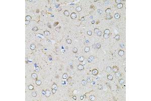Immunohistochemistry (Paraffin-embedded Sections) (IHC (p)) image for anti-Bestrophin 1 (BEST1) (AA 200-300) antibody (ABIN1678855)