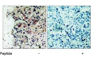 Image no. 1 for anti-Janus Kinase 1 (JAK1) (Tyr1022) antibody (ABIN197301) (JAK1 抗体  (Tyr1022))